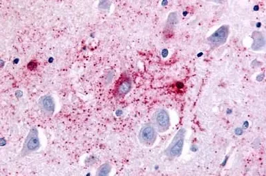 Anti-GPR89A antibody used in IHC (Paraffin sections) (IHC-P). GTX71777