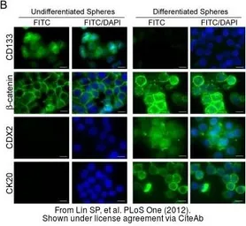 Anti-Cytokeratin 20 antibody [Ks20.8] used in Immunocytochemistry/ Immunofluorescence (ICC/IF). GTX72046
