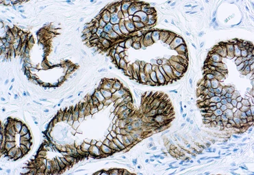 Anti-EpCAM antibody [VU-1D9] (ready-to-use) used in IHC (Paraffin sections) (IHC-P). GTX73513