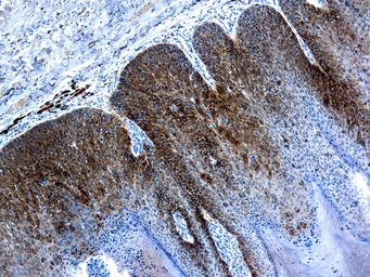 Anti-Human Papillomavirus type 16 L1 antibody [CamVir 1] used in IHC (Paraffin sections) (IHC-P). GTX73652