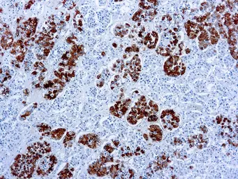 Anti-ACTH antibody [AH26] used in IHC (Paraffin sections) (IHC-P). GTX73794