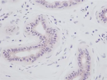 Anti-IL1 alpha antibody used in IHC (Paraffin sections) (IHC-P). GTX74157