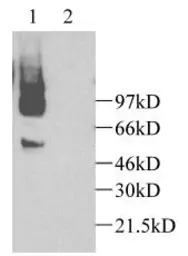 Anti-CX3CL1 antibody used in Western Blot (WB). GTX74237