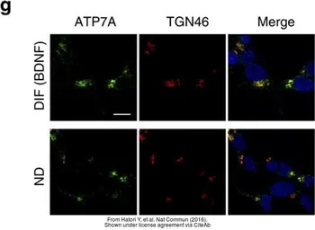 Anti-TGN46 antibody used in Immunocytochemistry/ Immunofluorescence (ICC/IF). GTX74290