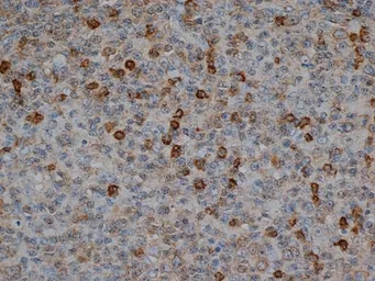 Anti-CD57 antibody [TB01] used in IHC (Paraffin sections) (IHC-P). GTX74868