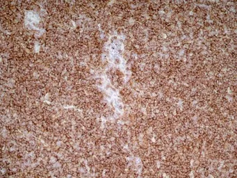 Anti-CD4 antibody [OX-35] (Azide free) used in IHC (Frozen sections) (IHC-Fr). GTX75110