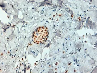 Anti-Estrogen Receptor alpha antibody [6F11] used in IHC (Paraffin sections) (IHC-P). GTX75362