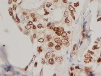 Anti-Progesterone Receptor antibody [1A6] used in IHC (Paraffin sections) (IHC-P). GTX75363