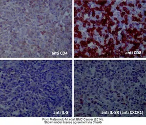 Anti-CD8 antibody [4B11] used in IHC (Frozen sections) (IHC-Fr). GTX75394