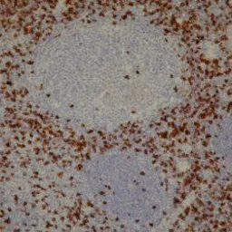 Anti-CD8 antibody [4B11] used in IHC (Paraffin sections) (IHC-P). GTX75394