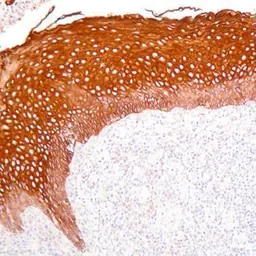 Anti-pan Cytokeratin antibody [AE1/AE3] used in Immunohistochemistry (IHC). GTX75521
