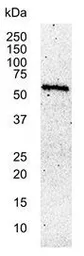 Anti-c-Myc antibody [9E10] used in Western Blot (WB). GTX75953