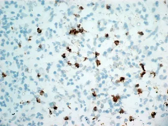 Anti-CD11b antibody [ICRF44] (Azide free) used in IHC (Frozen sections) (IHC-Fr). GTX76296