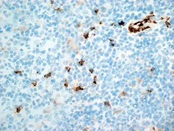 Anti-CD11b antibody [ICRF44] (Azide free) used in IHC (Frozen sections) (IHC-Fr). GTX76296