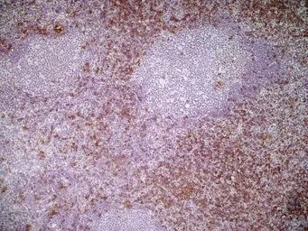 Anti-CD8 alpha antibody [KT15] used in IHC (Frozen sections) (IHC-Fr). GTX76351