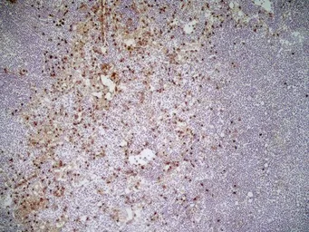 Anti-CD11b antibody [M1/70.15] used in IHC (Frozen sections) (IHC-Fr). GTX76473