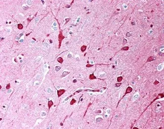 Anti-TGF beta antibody [TB21] used in IHC (Paraffin sections) (IHC-P). GTX76527