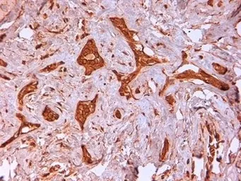 Anti-Cytokeratin 14 antibody [LL002] used in IHC (Paraffin sections) (IHC-P). GTX76603
