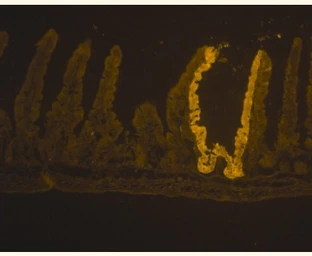 Anti-beta Galactosidase antibody used in Immunohistochemistry (IHC). GTX77365