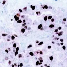 Anti-CENPF antibody [7F11.2] used in Immunohistochemistry (IHC). GTX77645