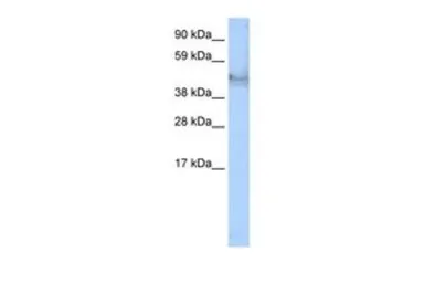 Anti-Cytokeratin 14 antibody, C-term used in Western Blot (WB). GTX77740