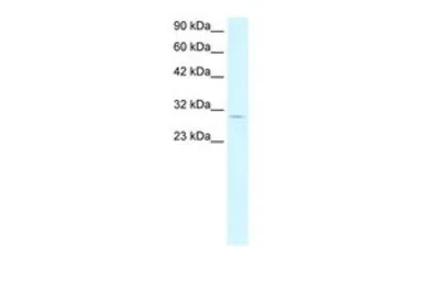 Anti-CDK4 antibody, C-term used in Western Blot (WB). GTX77799