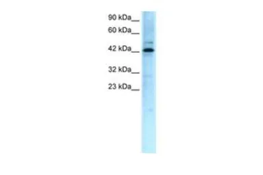 Anti-TCFL5 antibody, Internal used in Western Blot (WB). GTX77811