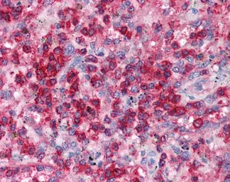 Anti-SNF8 antibody, N-term used in IHC (Paraffin sections) (IHC-P). GTX77812