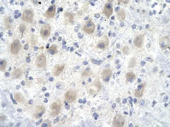 Anti-GAS41 antibody, Internal used in IHC (Paraffin sections) (IHC-P). GTX77840