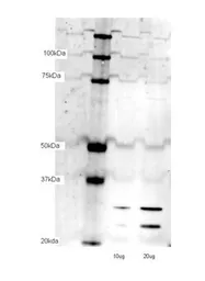 Anti-mtTFA antibody, N-term used in Western Blot (WB). GTX77852
