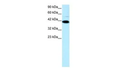 Anti-ZFP1 antibody, N-term used in Western Blot (WB). GTX77856