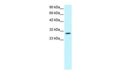 Anti-JMJD8 antibody, Internal used in Western Blot (WB). GTX77862