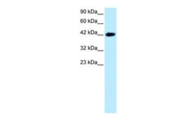 Anti-BARHL2 antibody, Internal used in Western Blot (WB). GTX77863