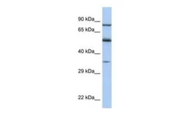 Anti-PAX4 antibody, Internal used in Western Blot (WB). GTX77866