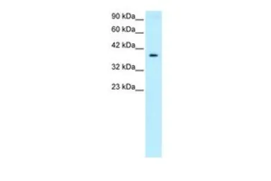 Anti-NT5C3 antibody, Internal used in Western Blot (WB). GTX77869
