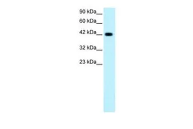 Anti-GATA3 antibody, C-term used in Western Blot (WB). GTX77882