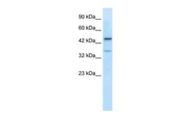 Anti-GATA3 antibody, C-term used in Western Blot (WB). GTX77882