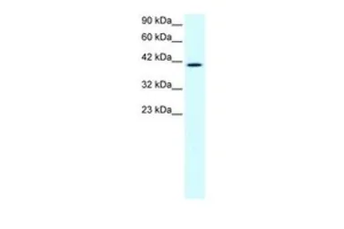 Anti-Nocturnin antibody, N-term used in Western Blot (WB). GTX77906