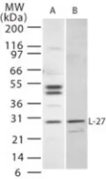 Anti-IL27 antibody used in Western Blot (WB). GTX77915