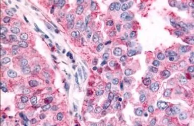 Anti-TAOK1 antibody used in IHC (Paraffin sections) (IHC-P). GTX78125