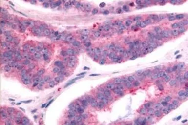 Anti-TAOK1 antibody used in IHC (Paraffin sections) (IHC-P). GTX78125