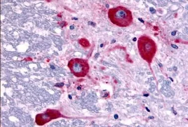 Anti-TAOK1 antibody used in IHC (Paraffin sections) (IHC-P). GTX78125