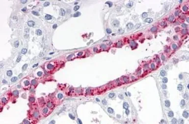 Anti-ADAMTS4 antibody used in IHC (Paraffin sections) (IHC-P). GTX78143