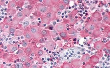 Anti-ADAMTS4 antibody used in IHC (Paraffin sections) (IHC-P). GTX78143