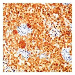 Anti-S100 antibody [4C4.9] (Biotin) used in IHC (Paraffin sections) (IHC-P). GTX78437