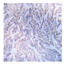 Anti-IRS1 antibody used in IHC (Paraffin sections) (IHC-P). GTX78916