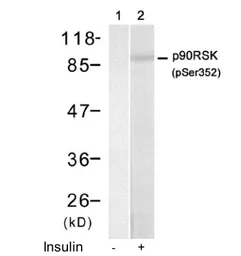 Anti-p90 RSK1 (phospho Ser363) antibody used in Western Blot (WB). GTX78975