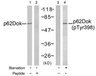 Anti-p62Dok (phospho Tyr398) antibody used in Western Blot (WB). GTX78980