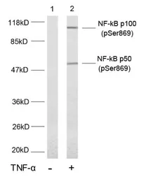 Anti-NFkB p100 (phospho Ser869) antibody used in Western Blot (WB). GTX79001
