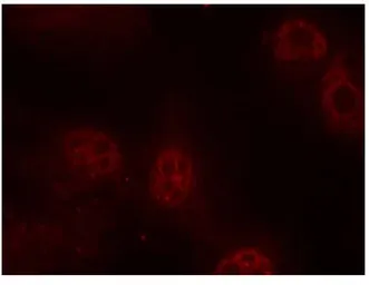 Anti-c-Myc (phospho Ser62) antibody used in Immunocytochemistry/ Immunofluorescence (ICC/IF). GTX79008